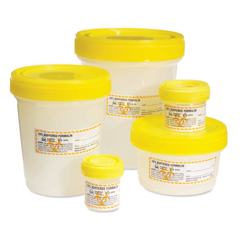 120mL Sterile Histology Containers, PN: 120049