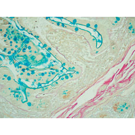 Histopathology Control Slides - Marketlab