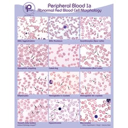 Peripheral Blood Posters - Marketlab
