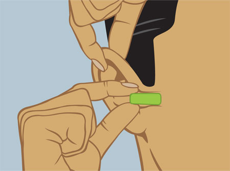 Drawing of person pulling their ear back and up while beginning to insert an ear plug